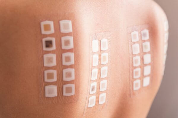 Allergologie und Allergietests - Hautarzt Augsburg