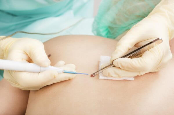 Operative Dermatologie - Hautarzt Augsburg